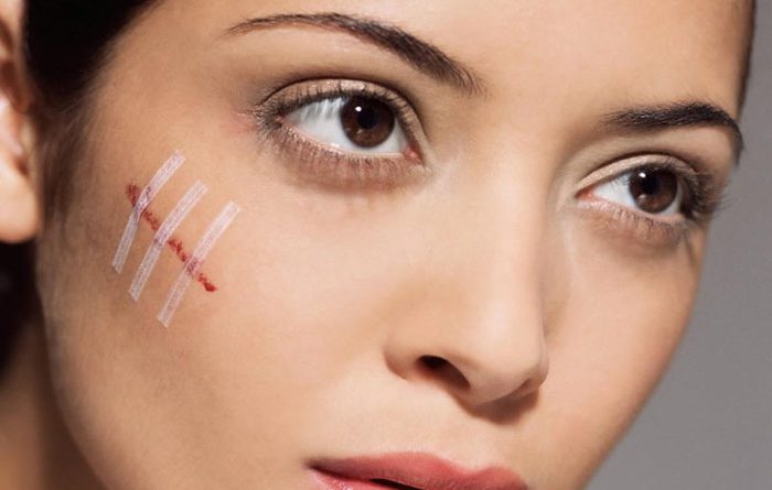 [Giải Đáp] Bị sẹo nên kiêng ăn gì để tránh Sẹo Lồi?